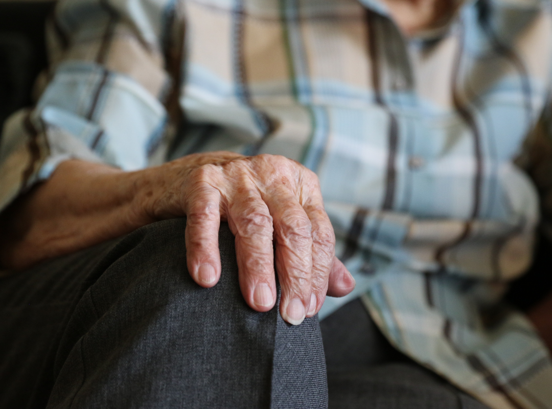 A senior citizens hand resting on her leg